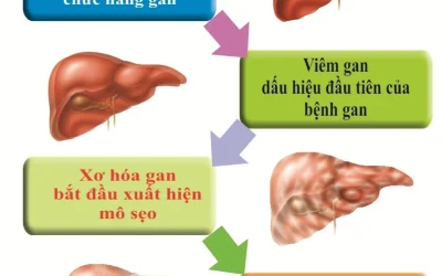 Thải độc gan là gì? Lợi ích và cách làm an toàn