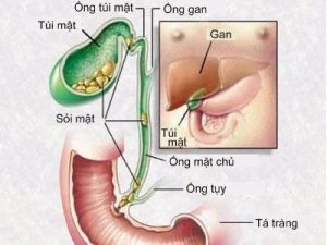 Thải độc thanh lọc cơ thể